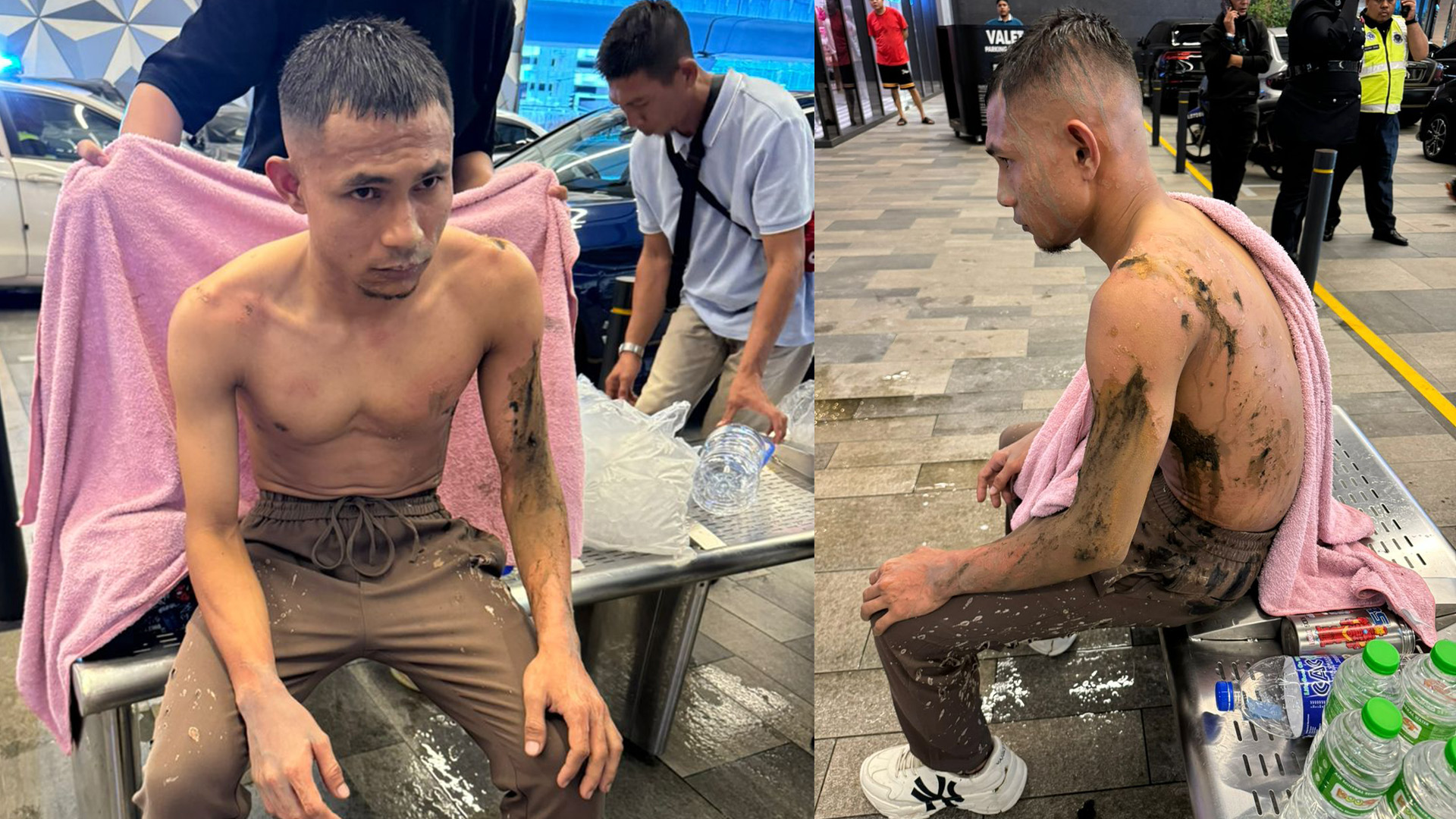 Malicious intent? Second footballer attacked this week, acid assault on Faisal Halim during family outing